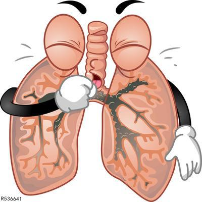 小细胞肺癌是如何引起的？ 